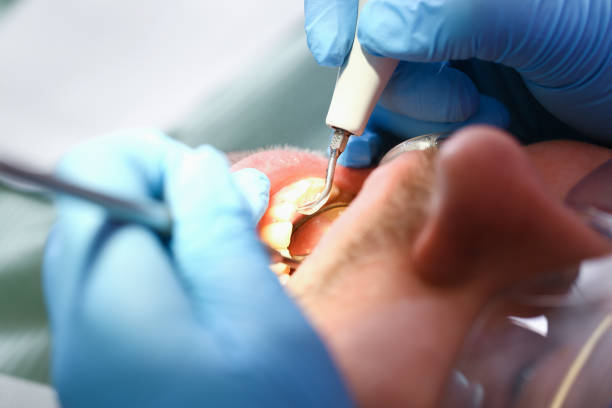 Best Emergency Tooth Extraction  in Lewisburg, WV